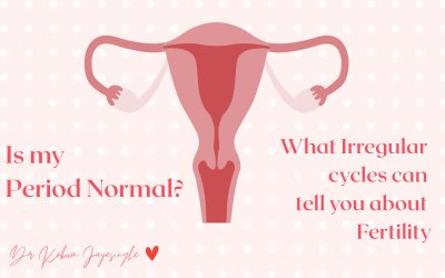 Is Your Period Normal? Understanding Irregular Cycles and PCOS