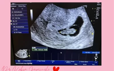 When Hope Becomes Real: Moments That Stay With Us in Fertility Care